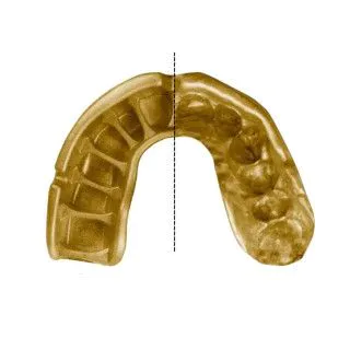 Капа OPRO Gold Grillz Black/Gold (art.102504012) 